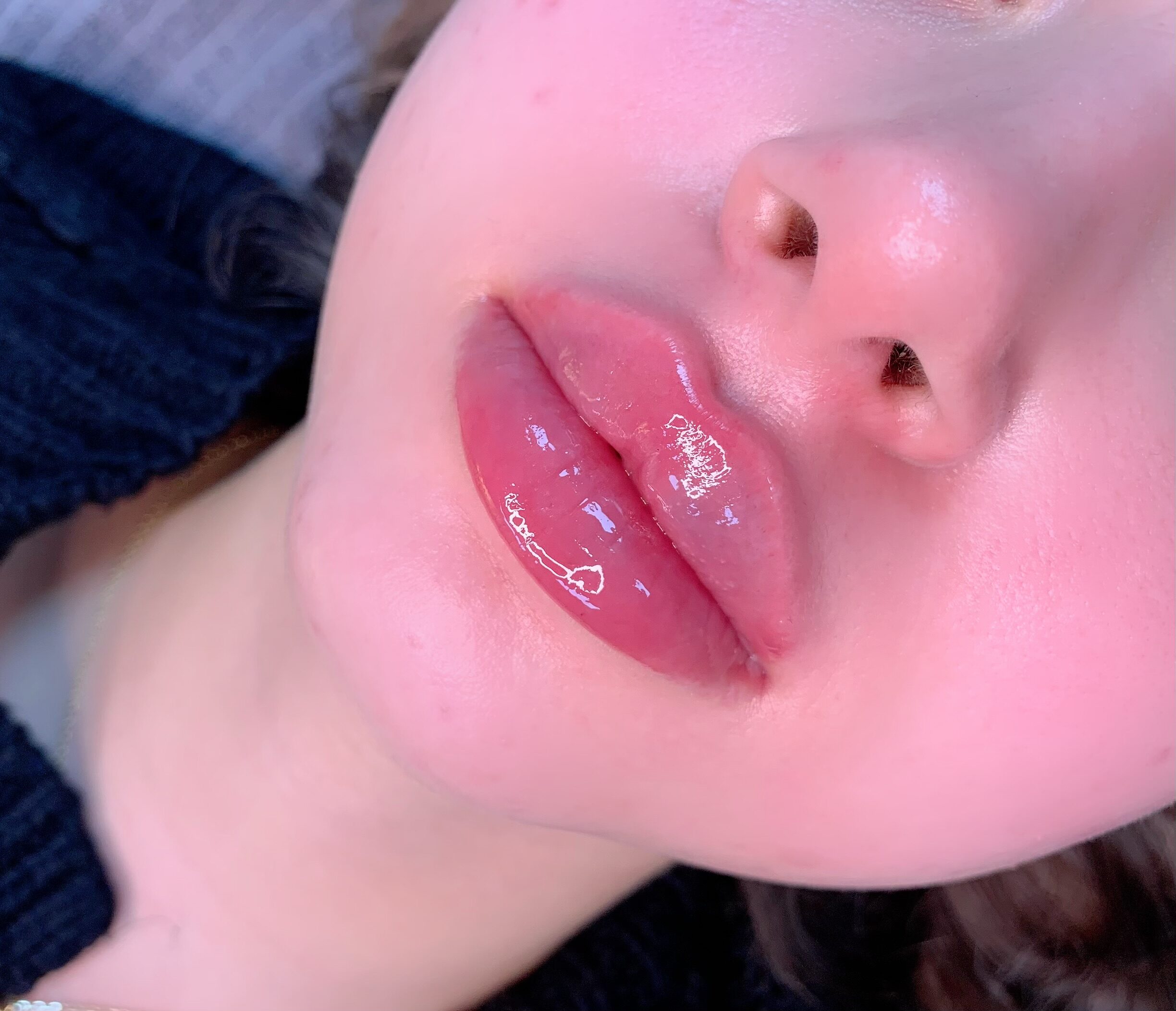 dicke Lippen