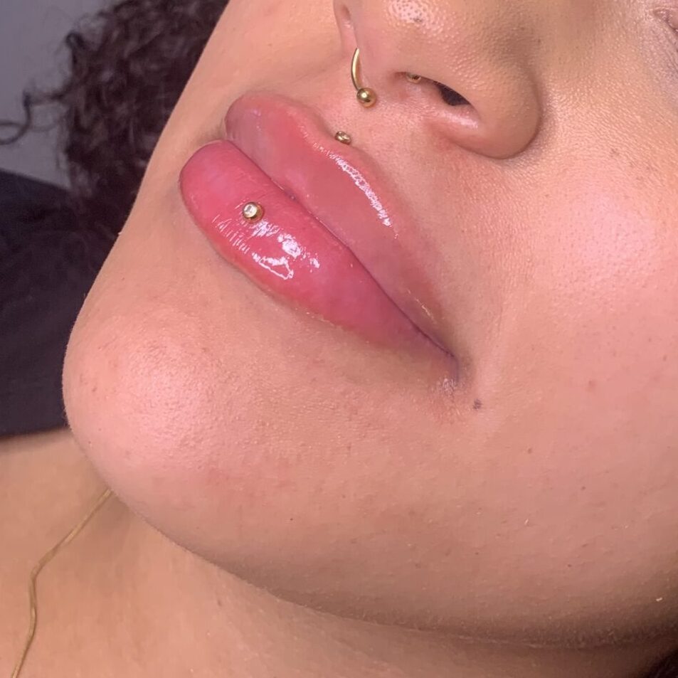 Lippen Füller